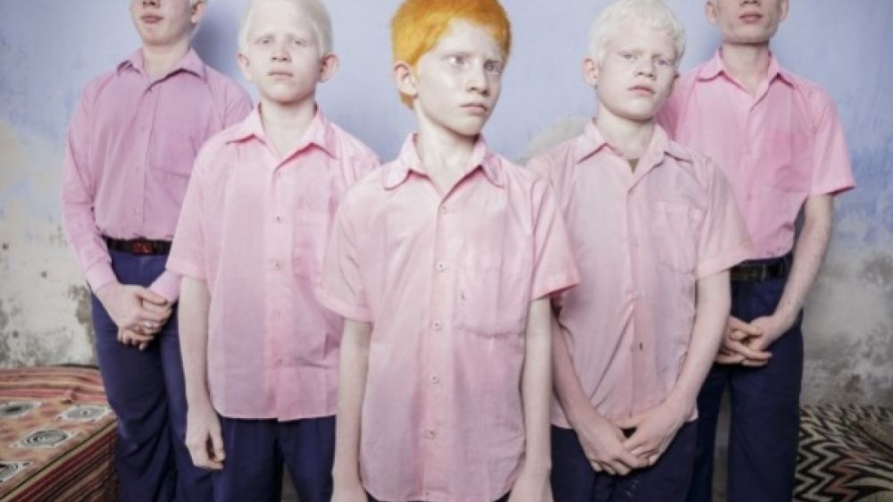 La photographie &quot;enfants indiens aveugles et albinos&quot; compte parmi les vainqueurs du Concours World Press Photo 2014 