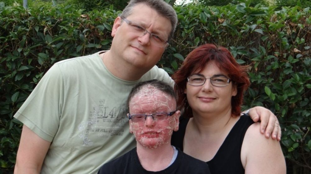 Marc Guillonneau et ses parents, Michel et Claire. Ils doivent trouver près de 40 000 euros chaque année pour soigner leur fils atteint du syndrome de Netherton.