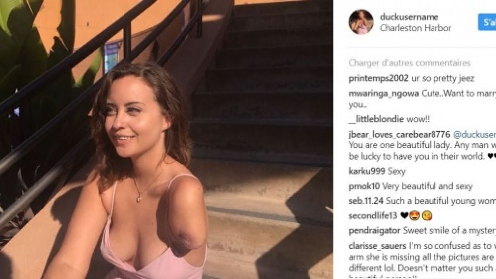 Lauren, 20 ans, a perdu son bras dans un accident de moto il y a un an