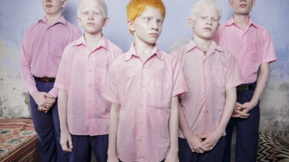 La photographie "enfants indiens aveugles et albinos" compte parmi les vainqueurs du Concours World Press Photo 2014